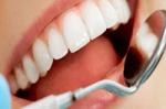 Как избавиться от зубного налета