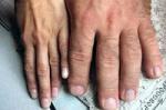 Как сделать пальцы толще