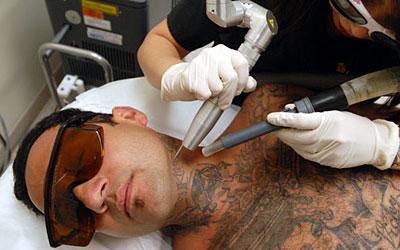 Как можно вывести татуировку